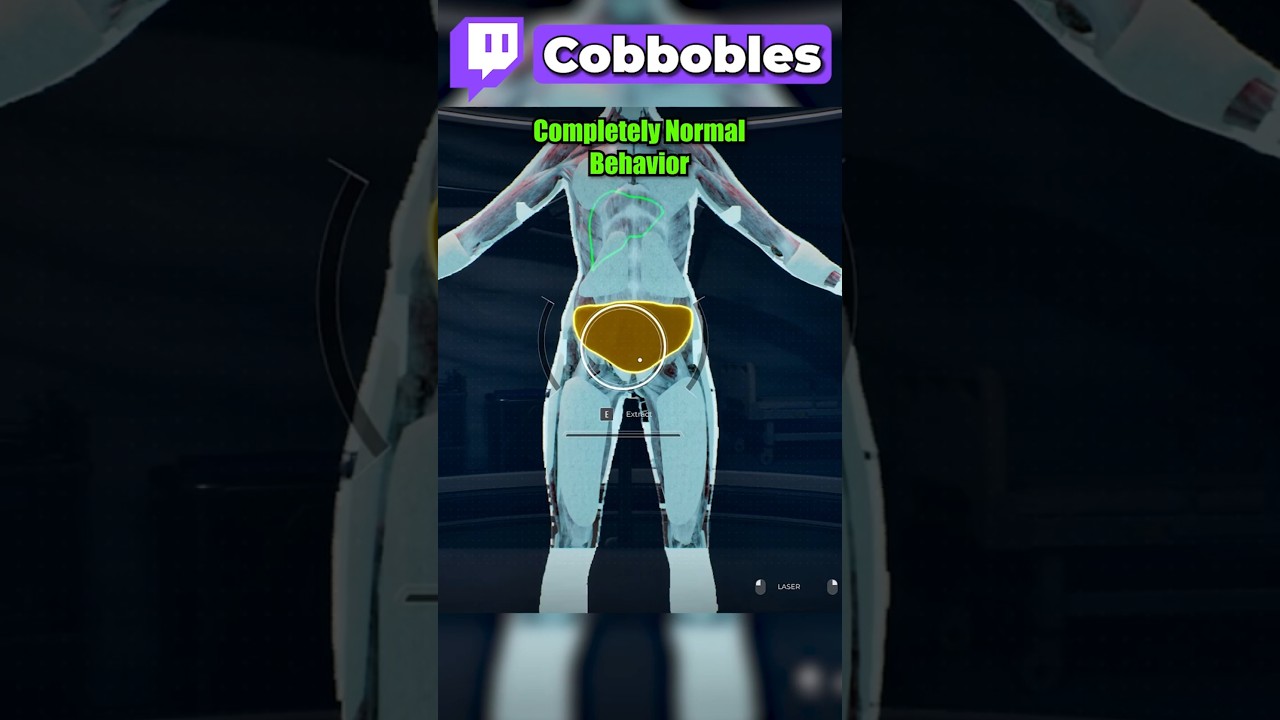 They Judged Me For This...