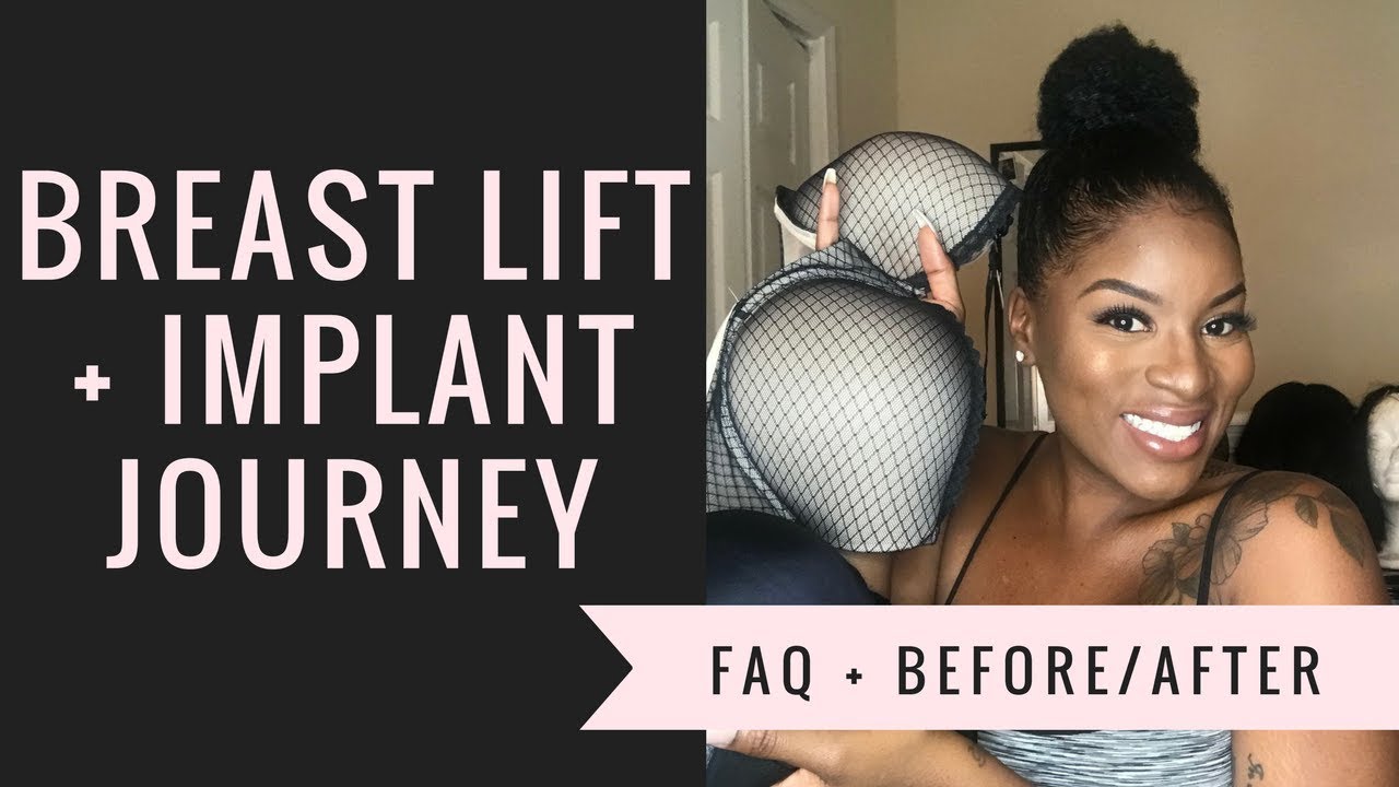 BREAST LIFT/IMPLANT : FAQ + BEFORE & AFTER
