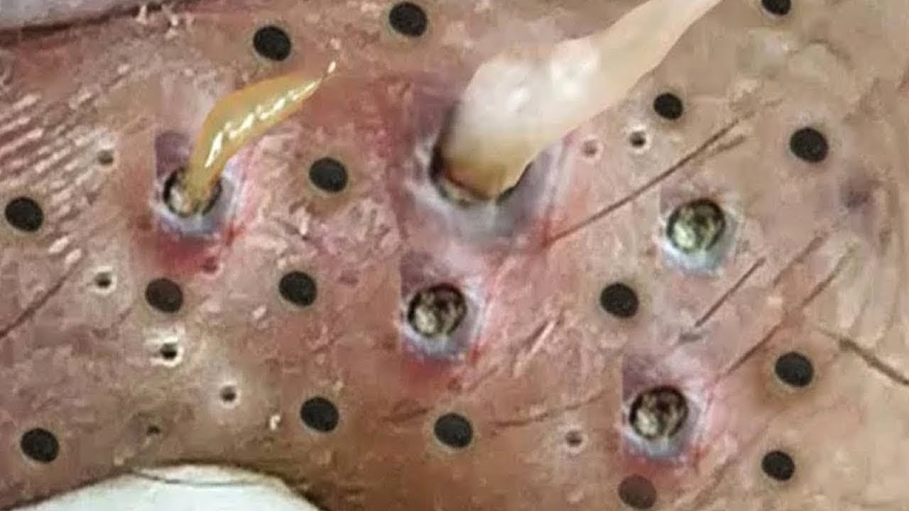 𝑺𝒐𝒐𝒕𝒉𝒊𝒏𝒈 𝑭𝒂𝒄𝒊𝒂𝒍 𝑻𝒓𝒆𝒂𝒕𝒎𝒆𝒏𝒕 𝑭𝒐𝒓 𝑺𝒕𝒓𝒆𝒔𝒔 𝑹𝒆𝒍𝒊𝒆𝒇 𝒂𝒕 𝑳𝒖𝒙𝒖𝒓𝒚 𝑺𝒑𝒂 𝑨𝒄𝒉𝒊𝒆𝒗𝒆 𝑰𝒏𝒏𝒆𝒓 𝑷𝒆𝒂𝒄𝒆 #500854