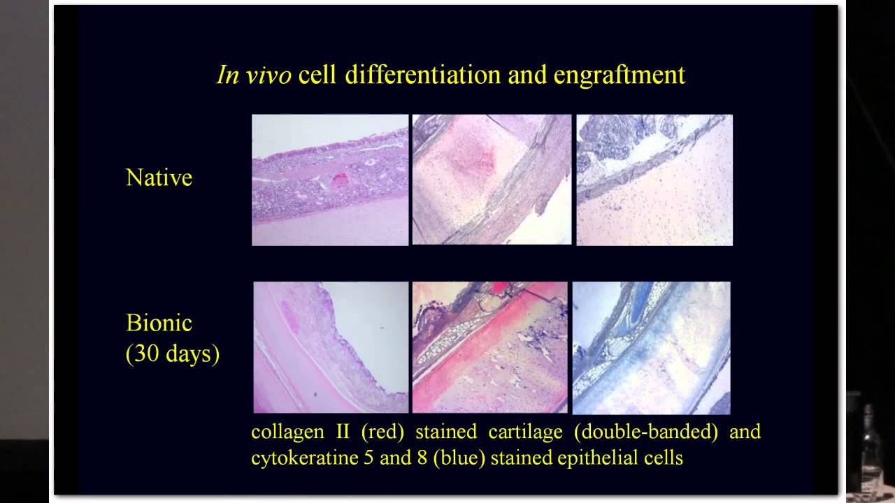 SENS5 - Trachea and oesophagus tissue engineering