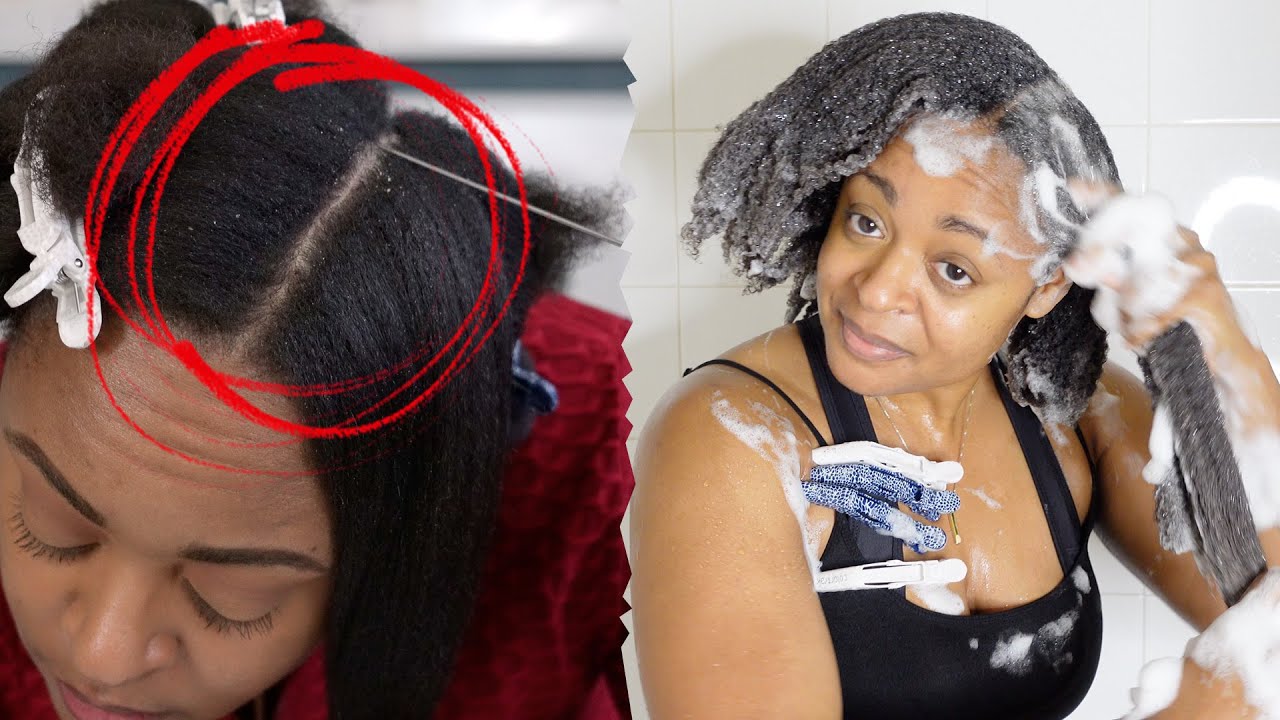 Get Rid Of SCALP BUILDUP | Seborrheic Dermatitis + Dandruff Wash Day Routine