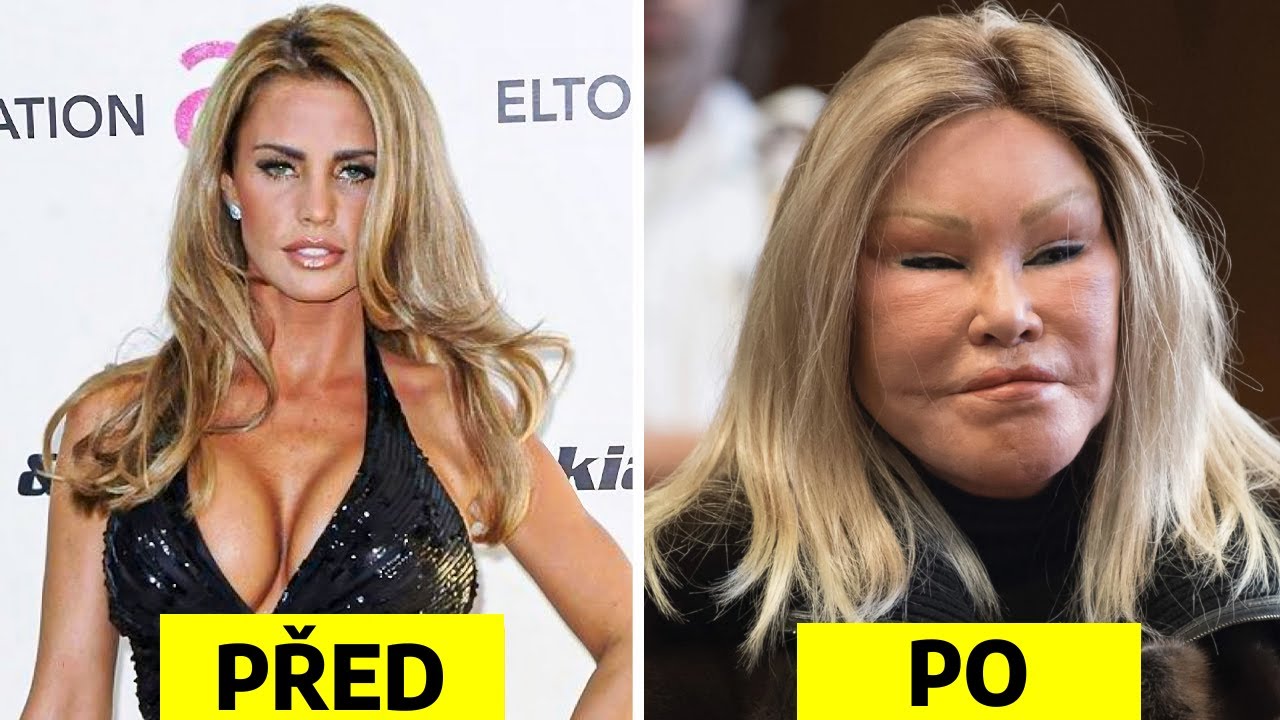 TOP 5 Celebrity a jejich zpackan&eacute; plastick&eacute; operace