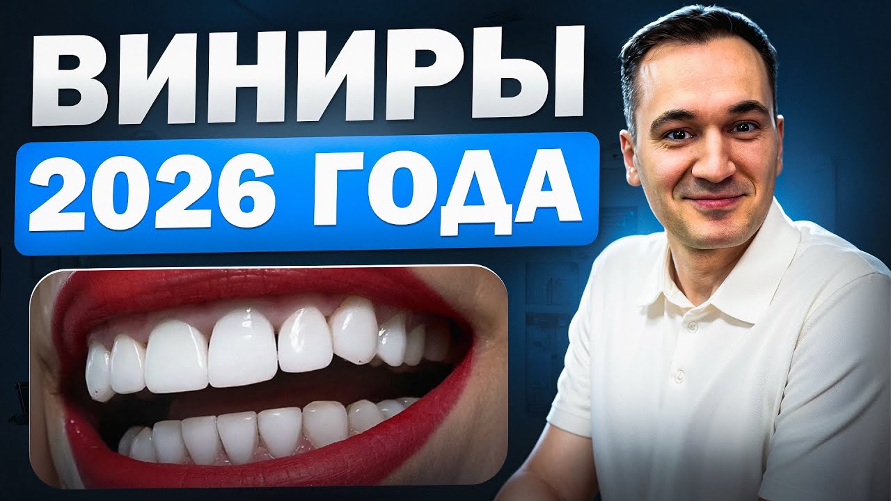 ВИНИРЫ 2026 ГОДА! КАКИЕ ВИНИРЫ ВЫБРАТЬ, КОГДА НУДНО УСТАНАВЛИВАТЬ ВИНИРЫ И КАК ЭТО ПРОИСХОДИТ