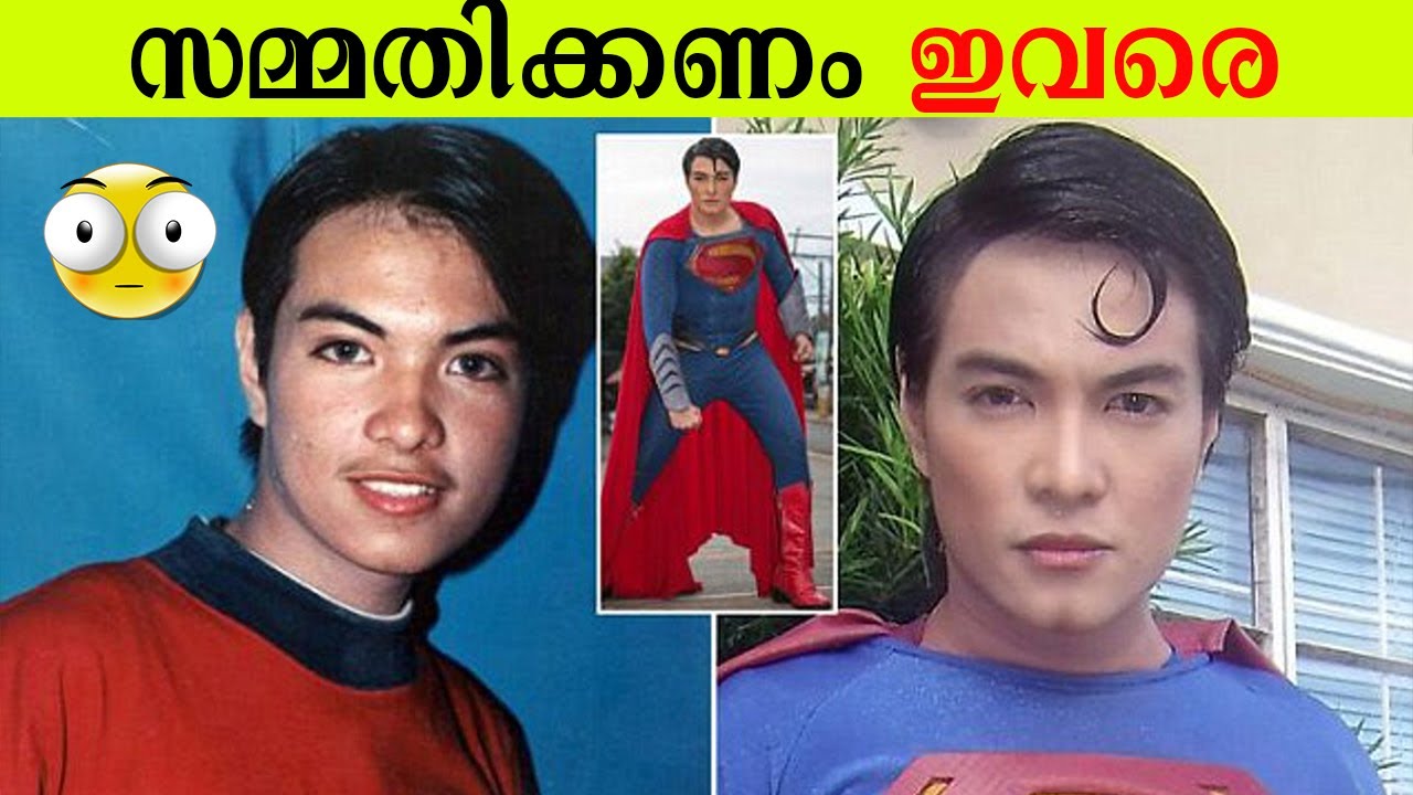 പ്ലാസ്റ്റിക് സർജറിയിലൂടെ ഞെട്ടിക്കുന്ന രൂപമാറ്റം വരുത്തിയ വ്യക്തികൾ