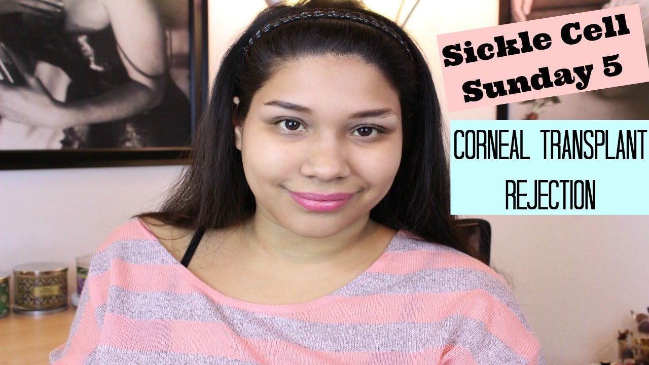 Sickle Cell Sunday 5~Corneal Transplant Rejection 🌙
