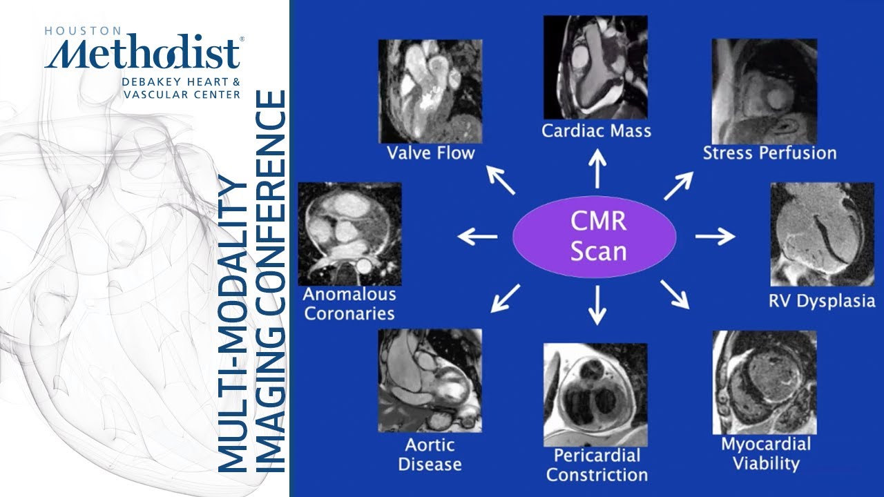 Cardiovascular MR: Basic Principles and Overview of Technique (Dipan Shah, MD) September 28, 2021