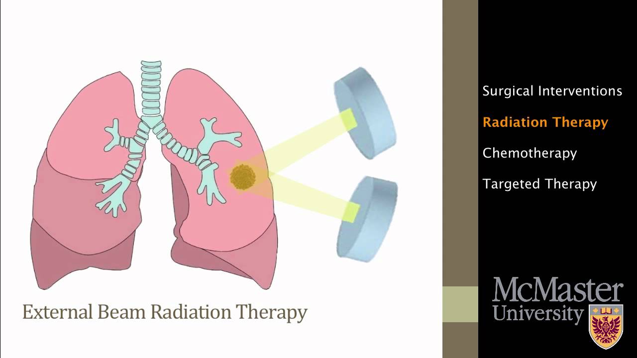 Lung Cancer: Common Treatments