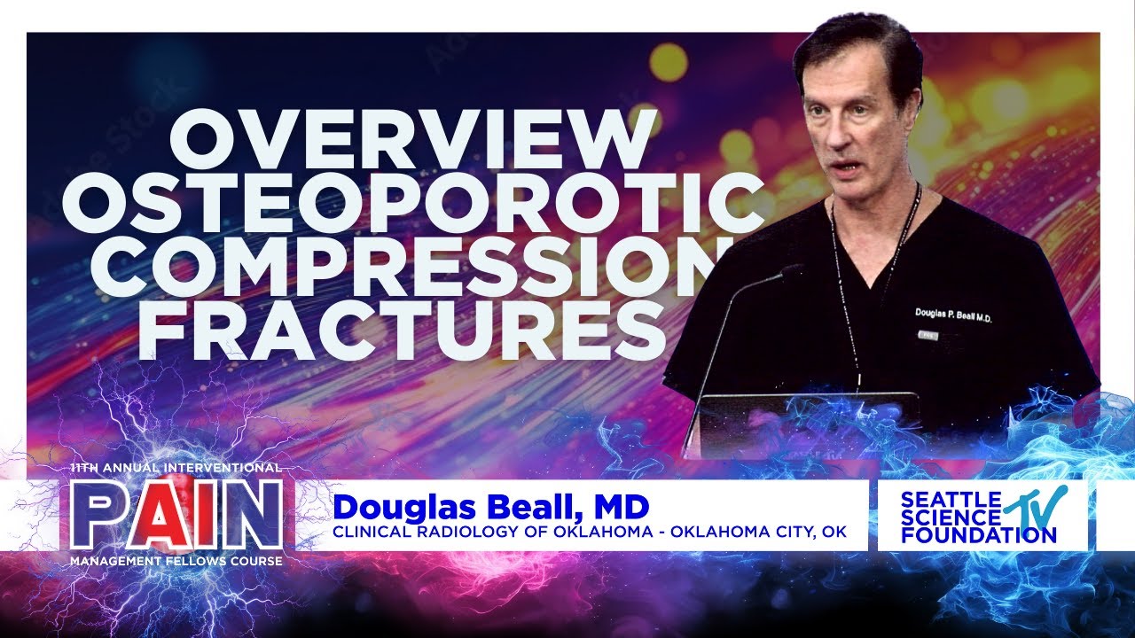 Overview Osteoporotic Compression Fractures - Douglas P Beall, M.D.