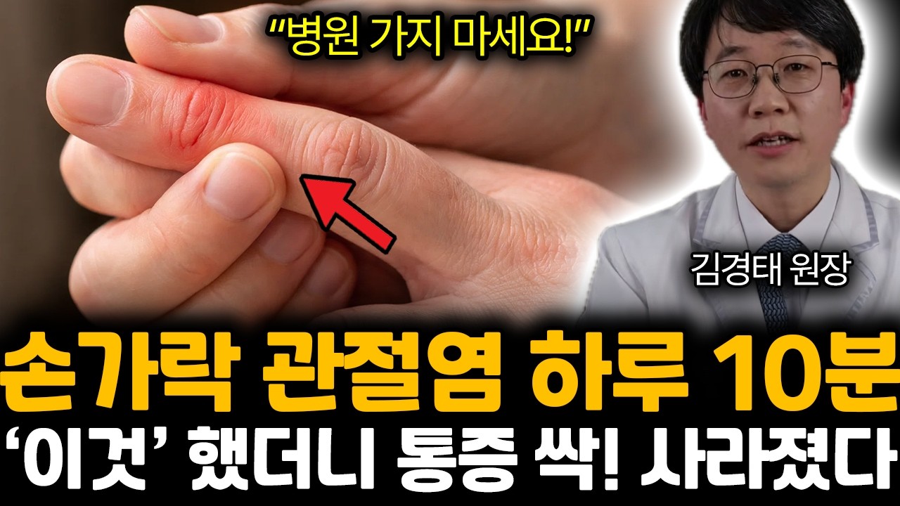 “병원 가지 마세요!” 손가락 관절염 하루 10분 ‘이것’ 했더니 통증 싹! 사라졌다 | 김경태 원장 3부