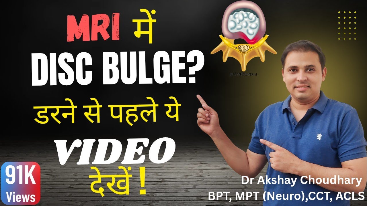 Disc Bulge in MRI? Watch This Video Before You Worry! #discbulge #slipdisc #backpain #L4L5S1 #MRI 