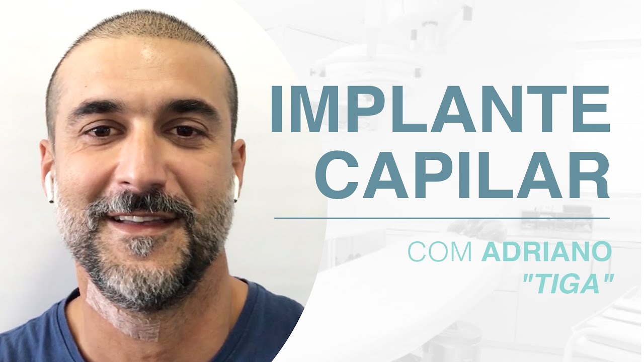 Implante Capilar com Adriano 
