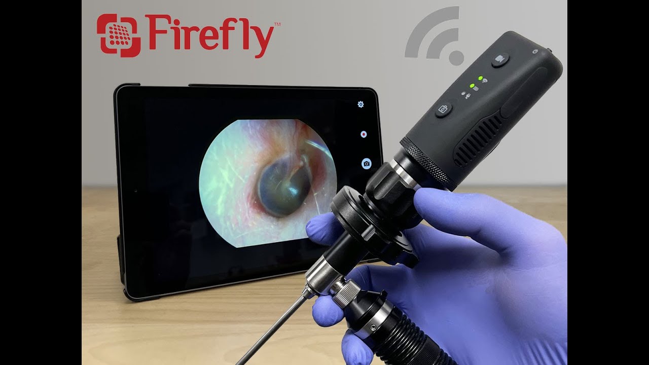 Firefly DE1270 HD Mobile Wireless Endoscope Camera