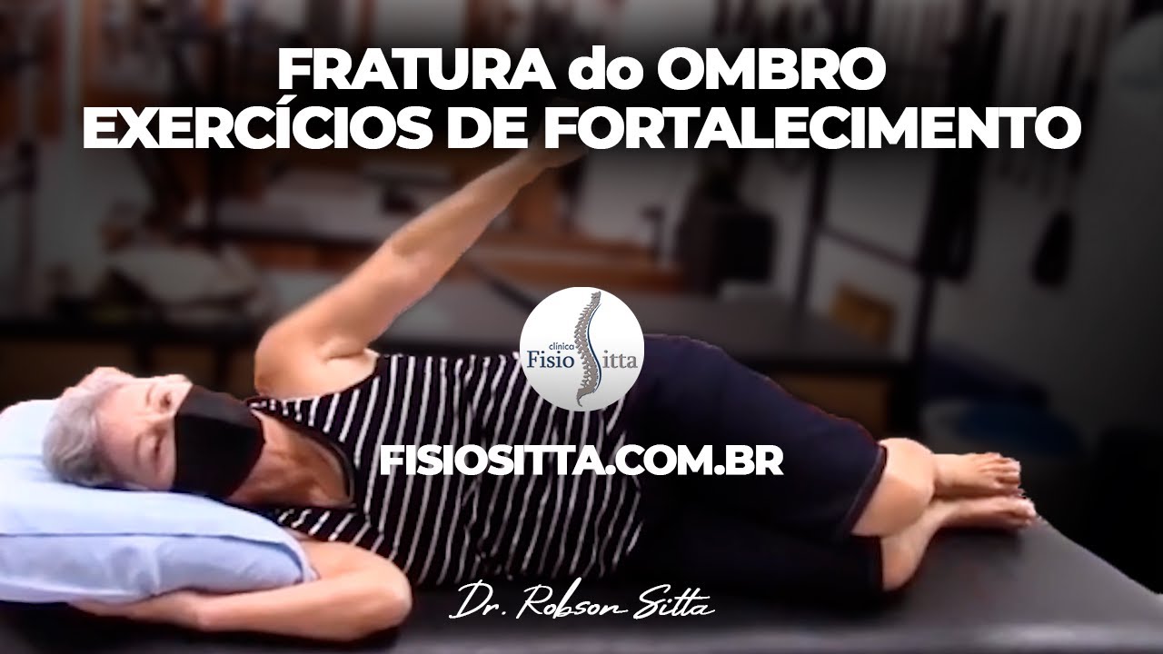 EXERCÍCIOS OMBRO FORTALECIMENTO FRATURA ÚMERO TRATAMENTO NÃO CIRÚRGICO Fisioterapia Dr. Robson Sitta