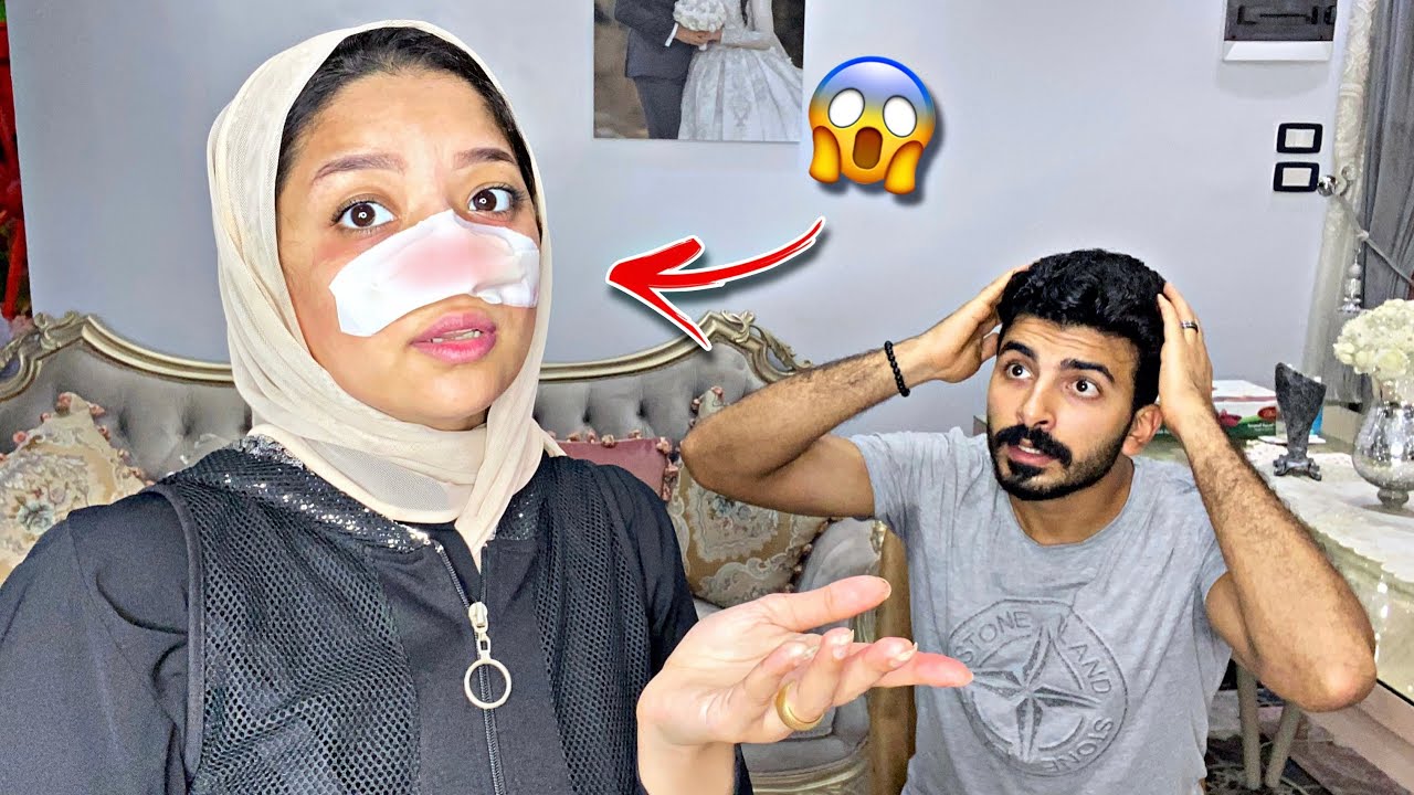 مقلب عملية التجميل فى زوجى🫣شوفو رد فعله اتعصب عليا ( للاسف )😢