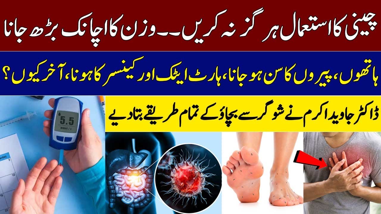 Dr. Javed Akram Explains Full Treatment of Diabetes | Diabetes Symptoms | Podcast |  SAMAA TV