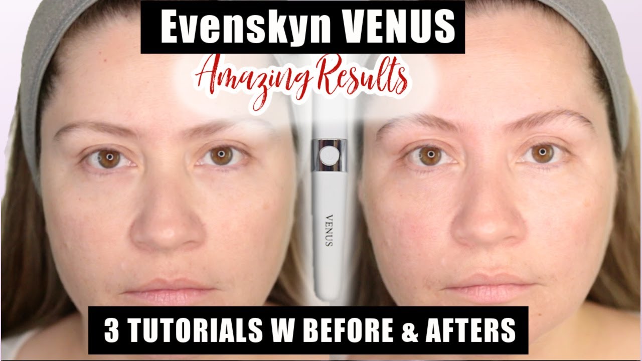 EvenSkyn VENUS| 3 FULL TUTORIALS W BEFORE & AFTER
