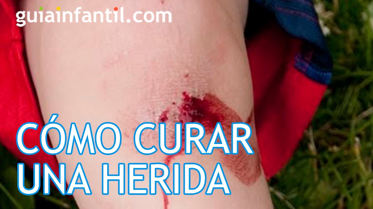 C&oacute;mo curar una herida paso a paso