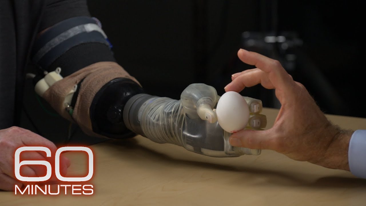 How advancements in prosthetic technology allow feeling, control | 60 Minutes