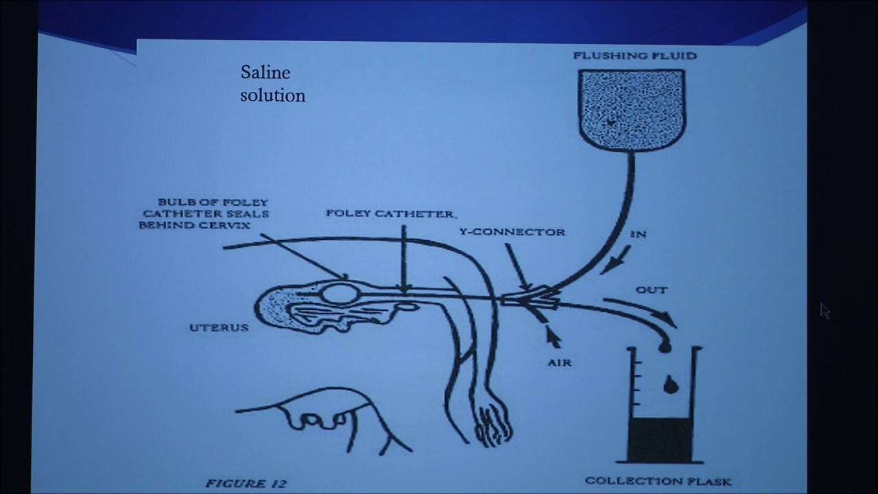 Bovine Embryo Transfer Facts-2 (Conventional Flush Method)