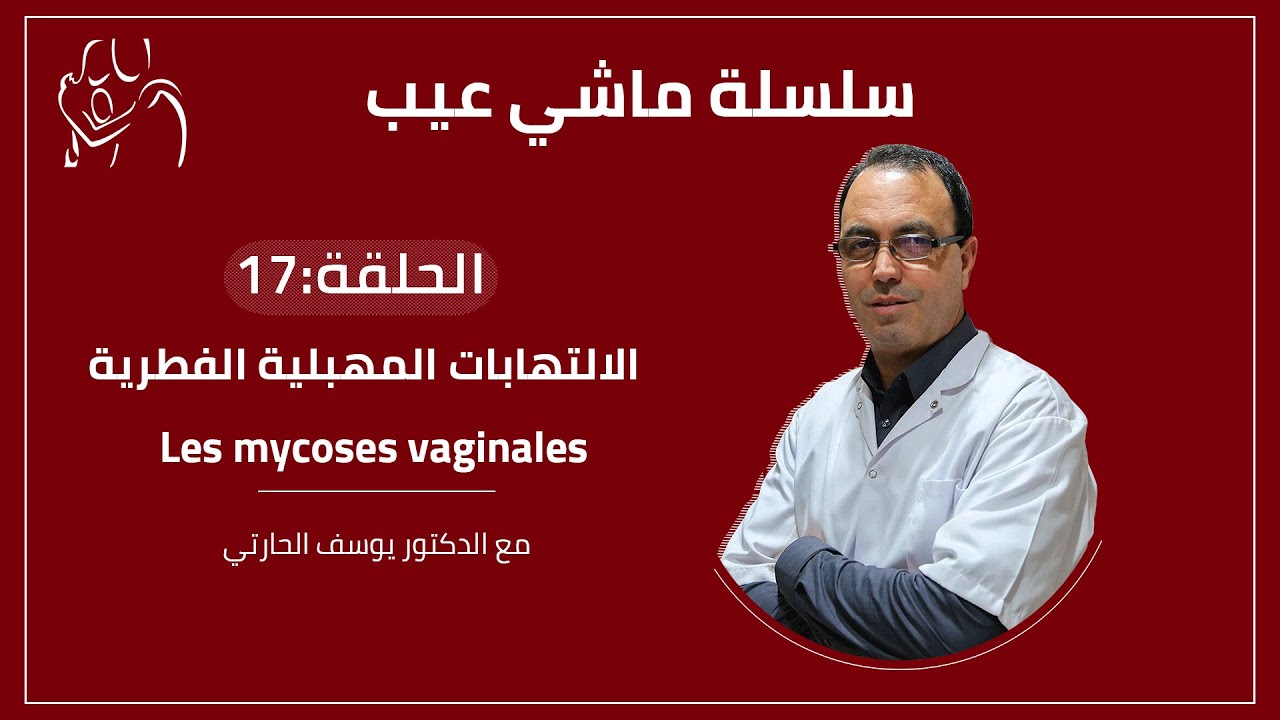 ماشي عيب  - الالتهابات المهبلية الفطرية - بث مباشر