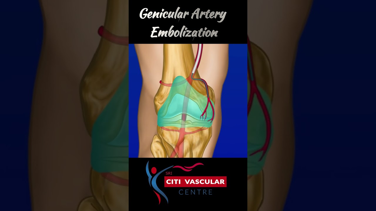 Knee pain treatment #shortsvideo #viralvidoes