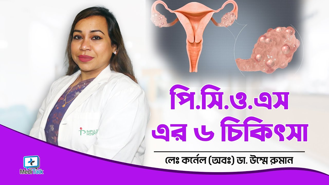 পিসিওএস এর ৬ চিকিৎসা | 6 Treatments of PCOS | Polycystic Ovary Syndrome | PCOS