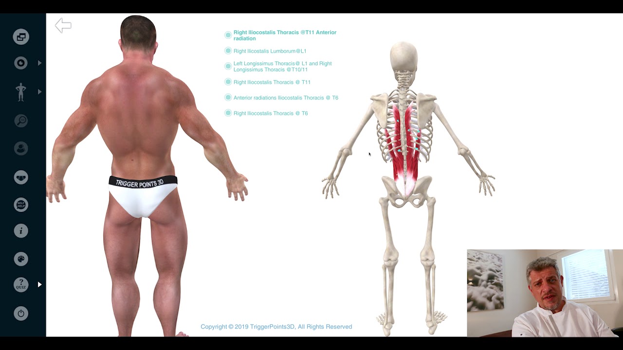 Trigger Point of the Week - Erector Spinae