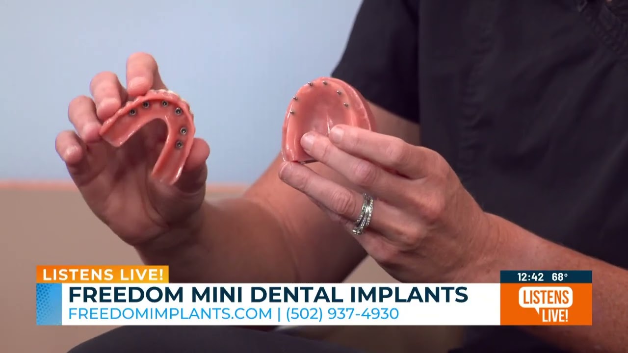 Freedom Mini Dental Implants Offers the Best Quality Dental Implants at a Price You Can Afford!