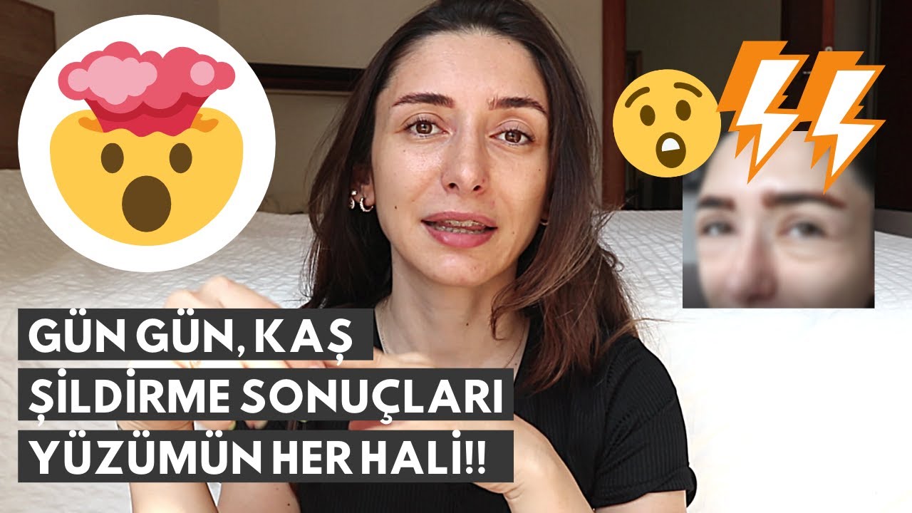 SOLÜSYON İLE KAŞ SİLDİRME, GÜN GÜN 4.SEANS SONUÇLARI, SİLİNDİ Mİ?