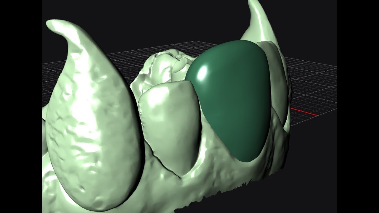 Gold Grillz (Golden Tooth Cover) in MatrixGold