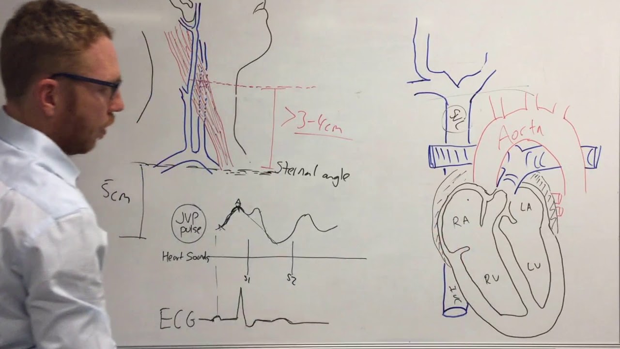 Jugular venous pressure