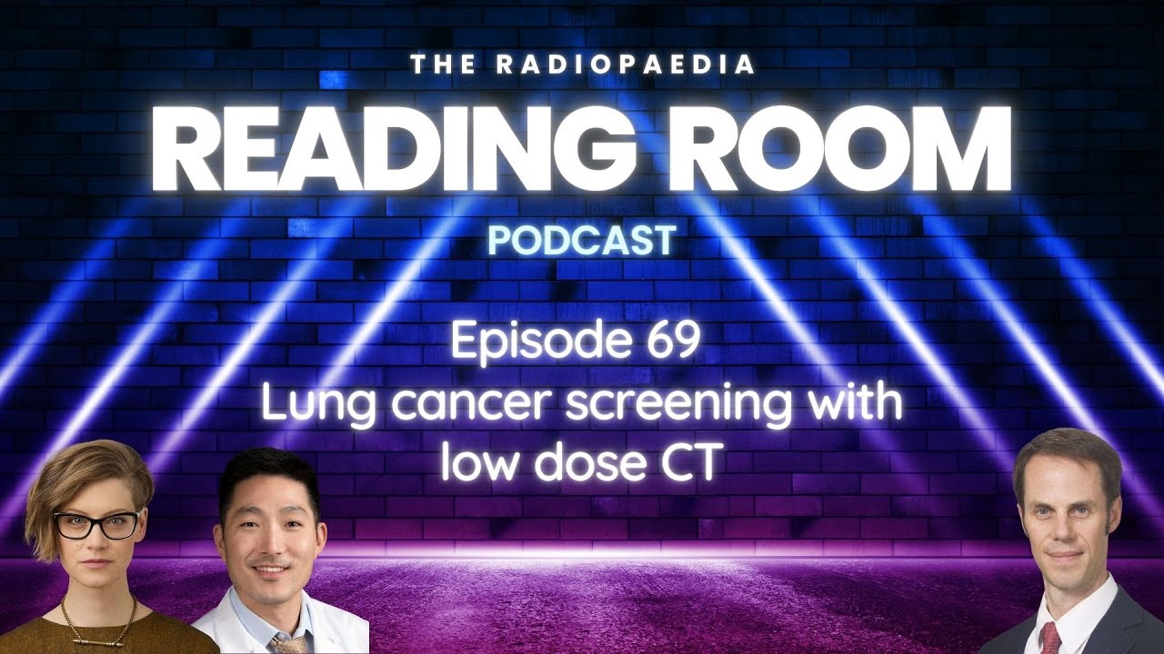 Lung cancer screening with Miranda Siemienowicz, Jeffrey Kanne & Jonathan Chung