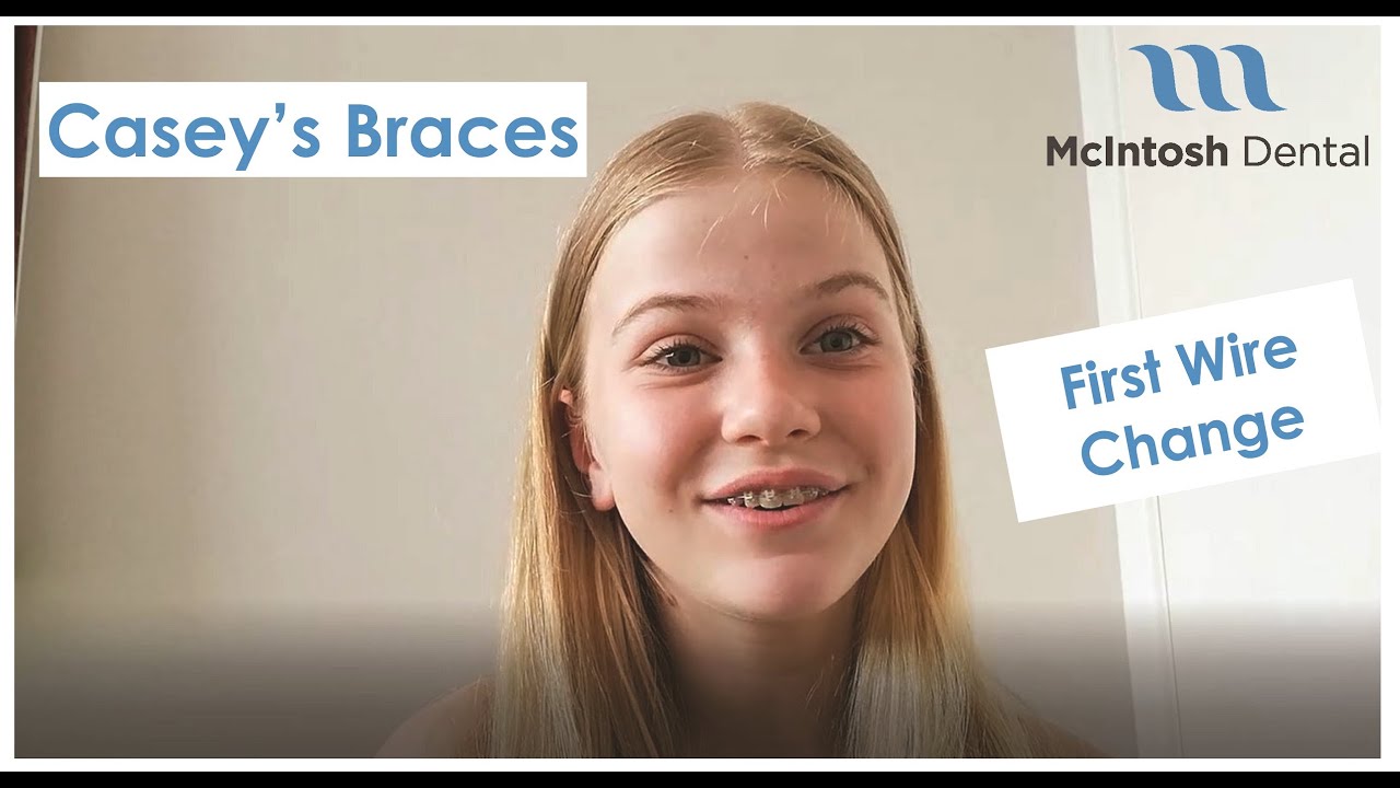Casey's Braces: First Braces Wire Change