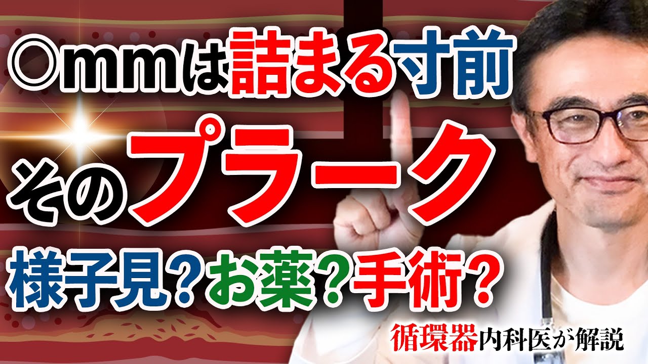 【緊急回答】質問：LDL147 首のプラーク1cmどうしたらいい？循環器内科医が悪玉コレステロールと頸動脈について解説