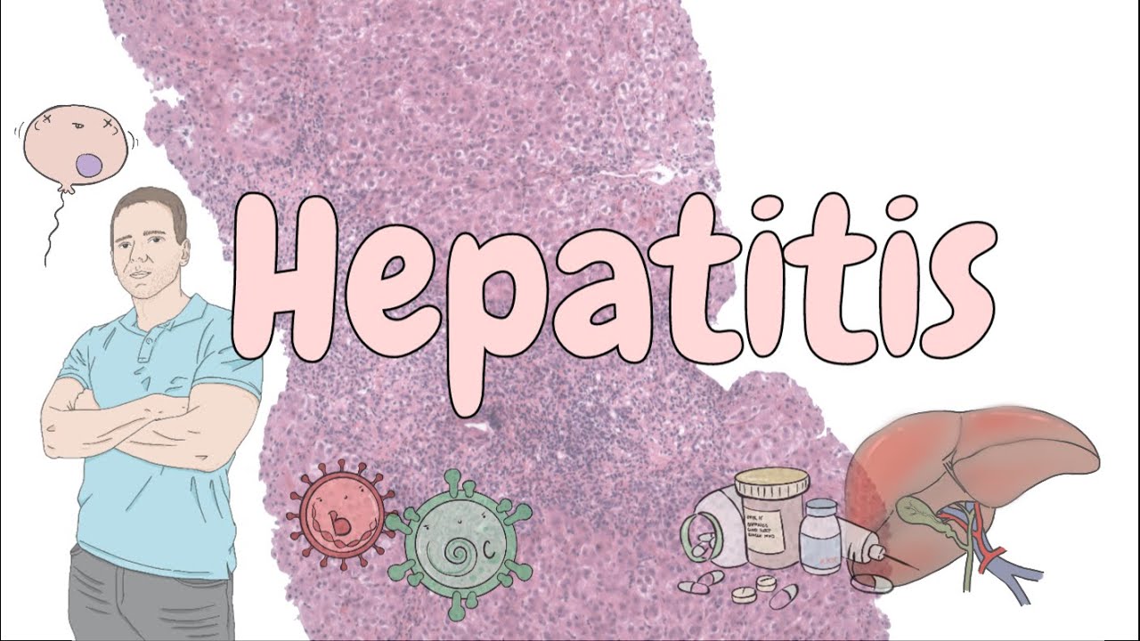 Hepatitis - liver pathology