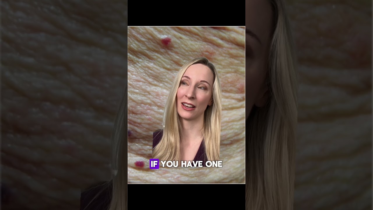 Do you think you have SCABIES? Watch this ⬆️ #dermatology #dermatologytips #skin