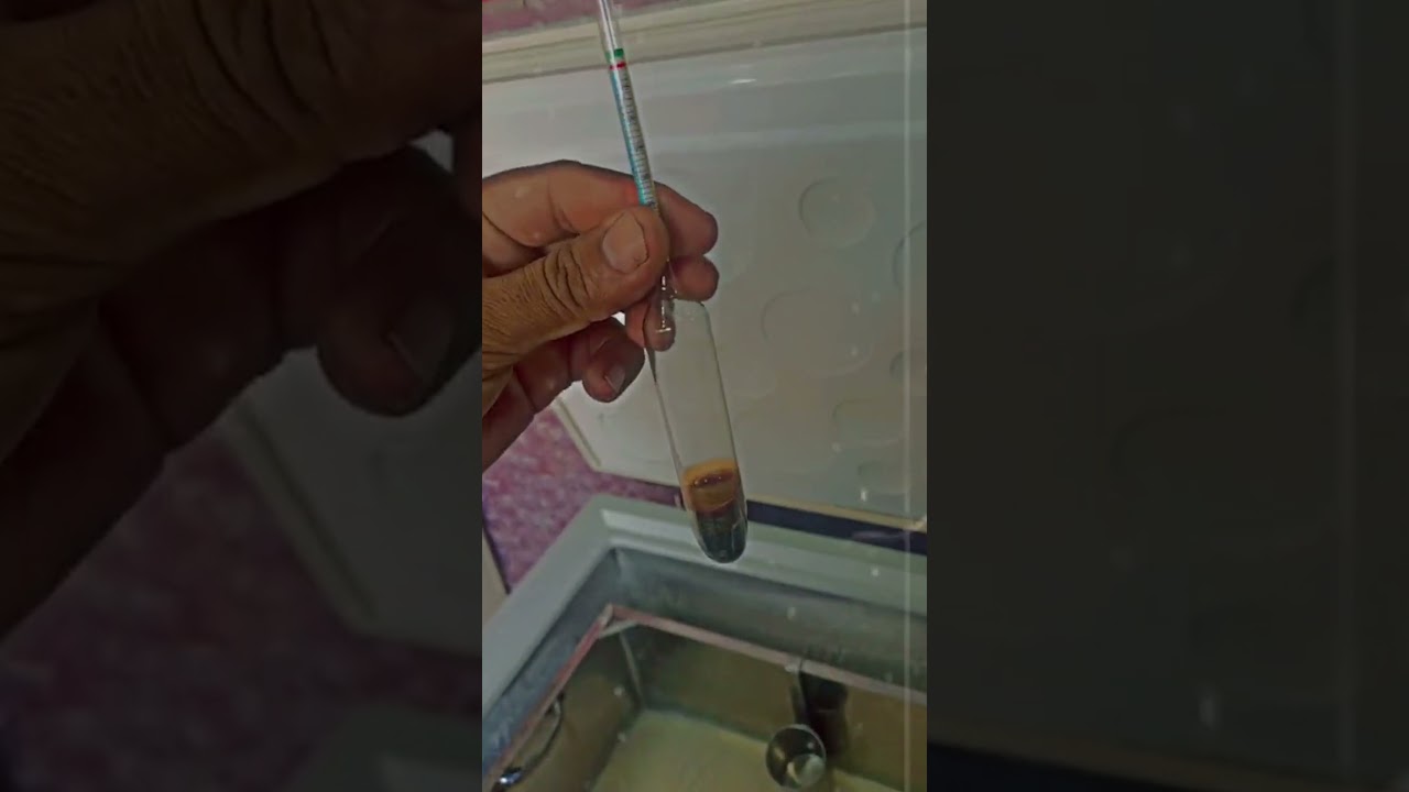 Milk Fat Measurement Made Simple |Butyrometer's Role in Gerber's Method #milk #milkfacts
