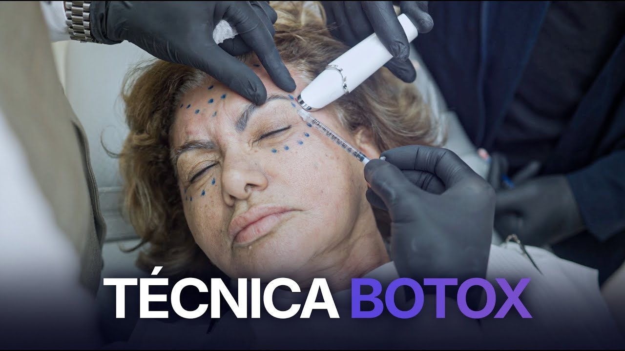 Técnica avancada de botox