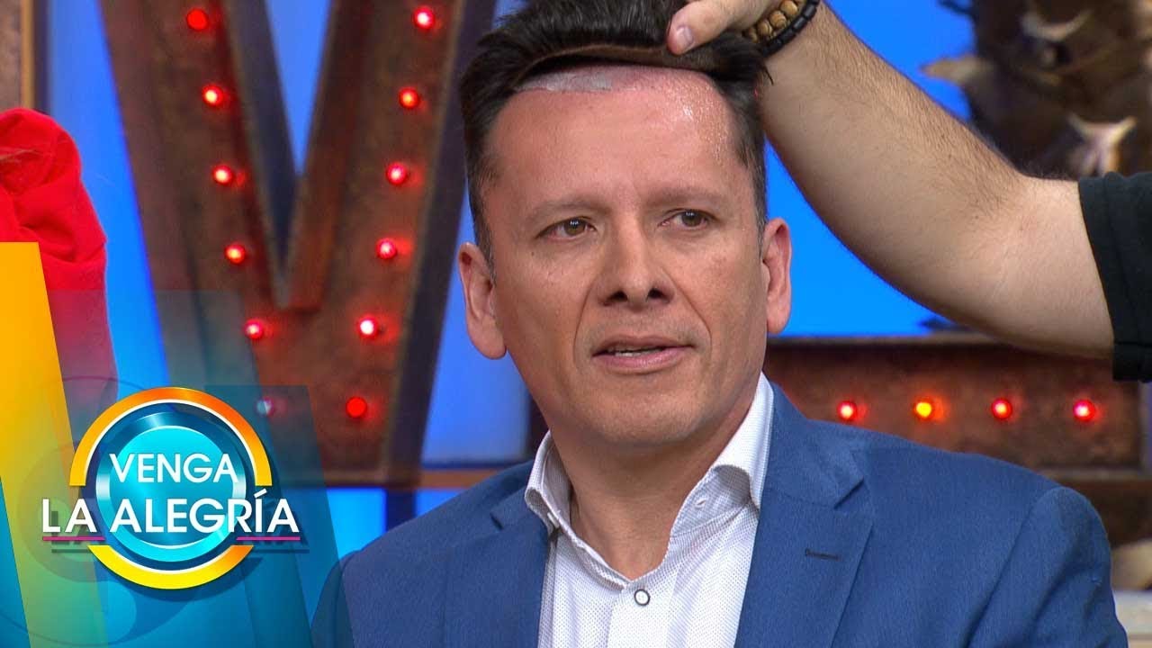 Descubre cómo funciona y los beneficios de usar una prótesis capilar.  | Venga La Alegría