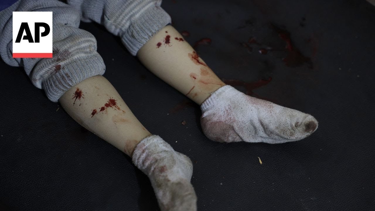 Syrian government forces and Kurdish fighters clash in Aleppo, injuring children