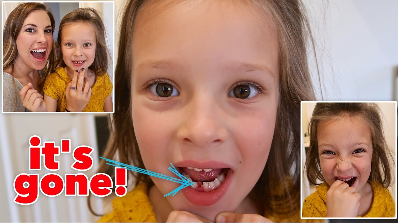 SHE RIPPED IT OUT! 😱