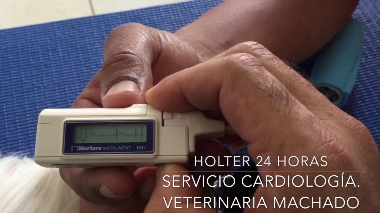 Holter 24 horas
