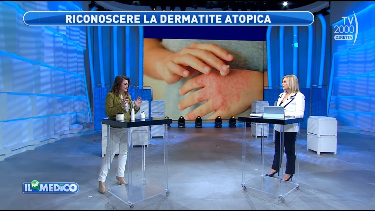 Il Mio Medico (TV2000) - Nuovi farmaci per il trattamento della dermatite atopica
