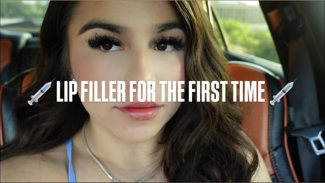 lip filler vlog💉(first time/pain?/recommend?)