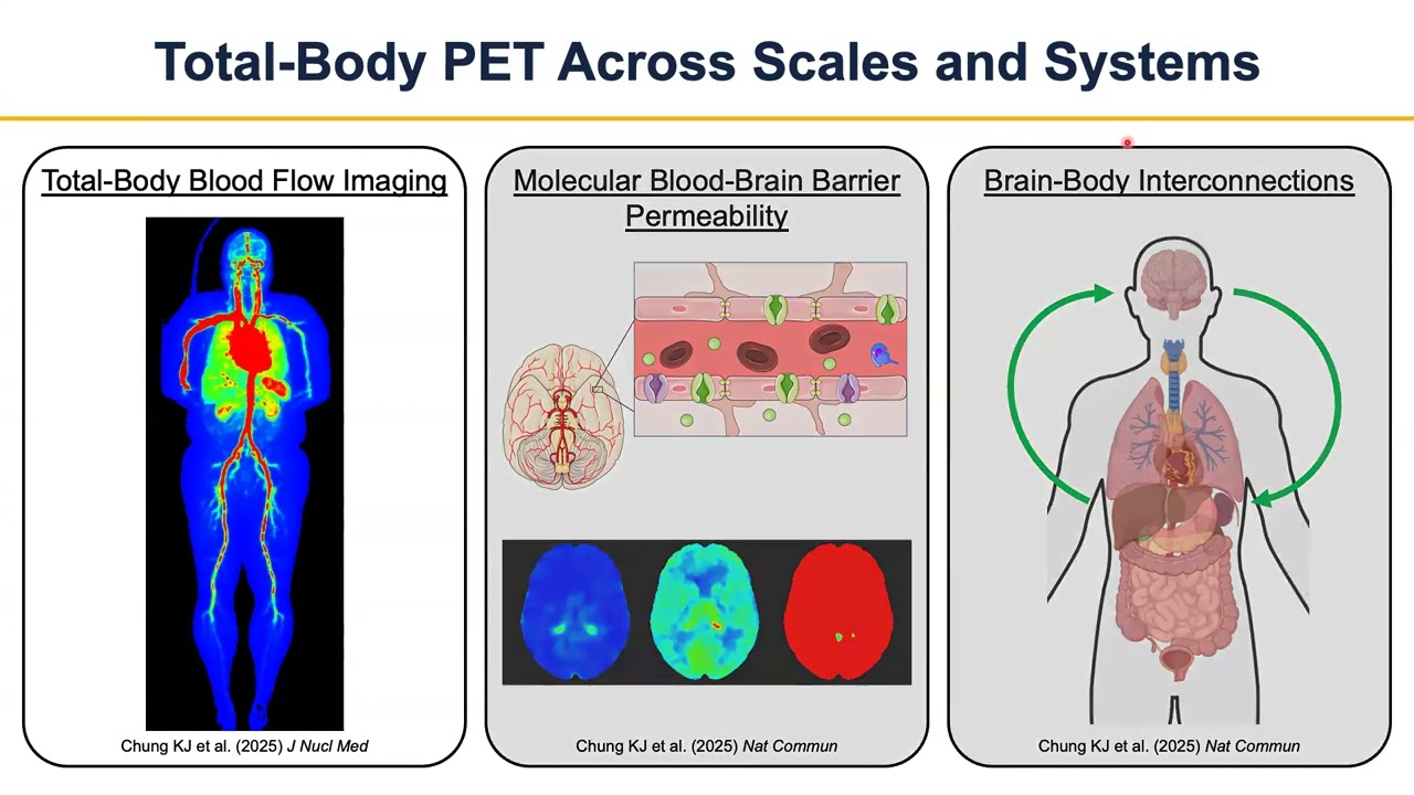 BrainMap - Kevin J Chung: Total-Body PET Across Scales and Systems