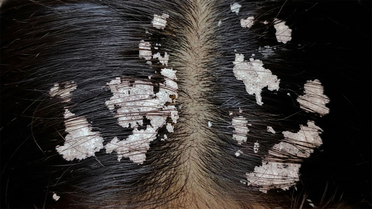 Hair Brushing & Scalp Scratching ASMR #S0029