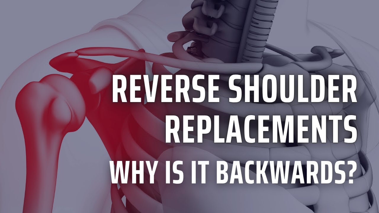 Reverse Total Shoulder Replacements Explained