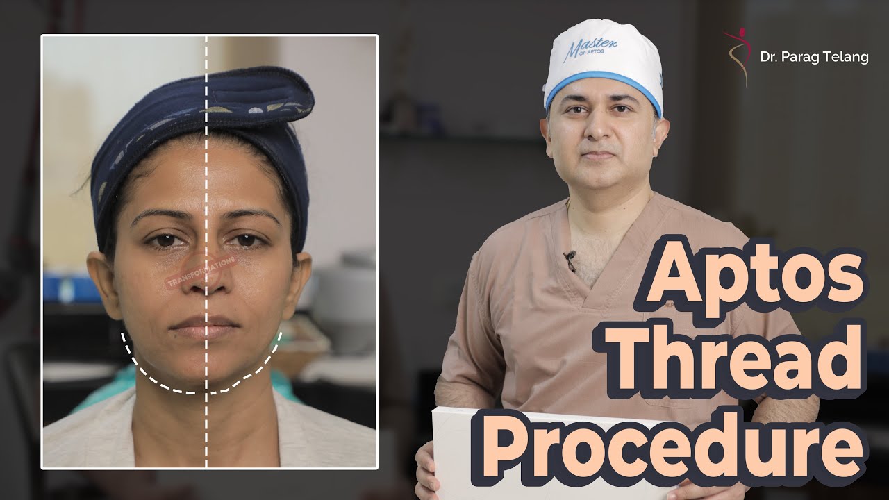 Non-Surgical Facelift Treatment | Aptos Threads Procedure & Results | Plastic Surgery in Mumbai