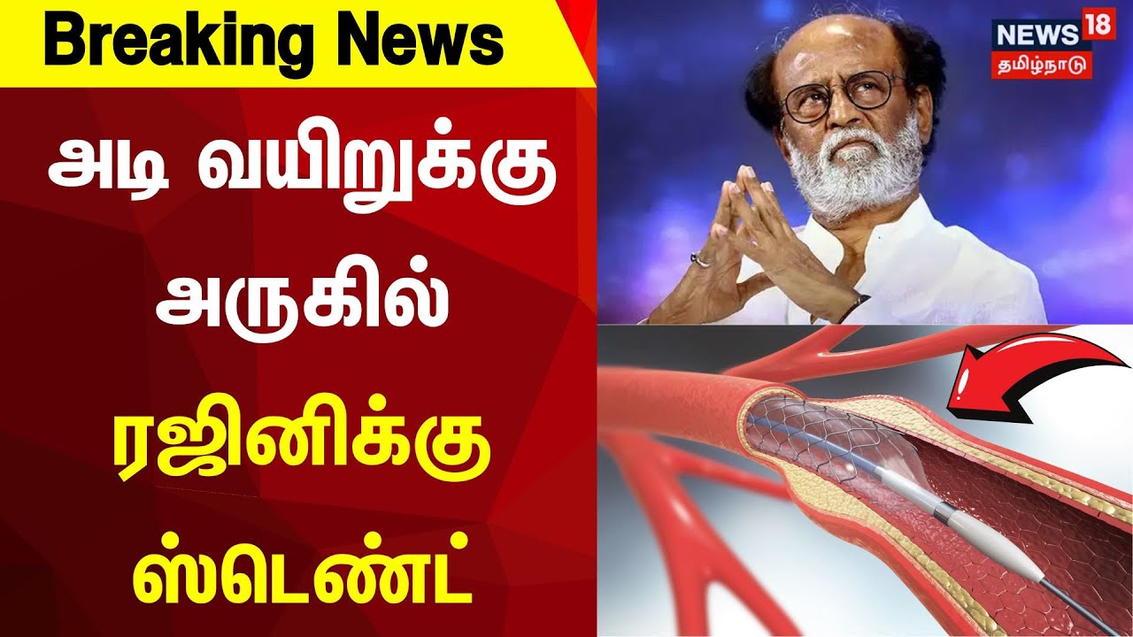 Actor Rajinikanth Admitted To Apollo Hospitals | அடி வயிறுக்கு அருகில் ரஜினிக்கு ஸ்டெண்ட்