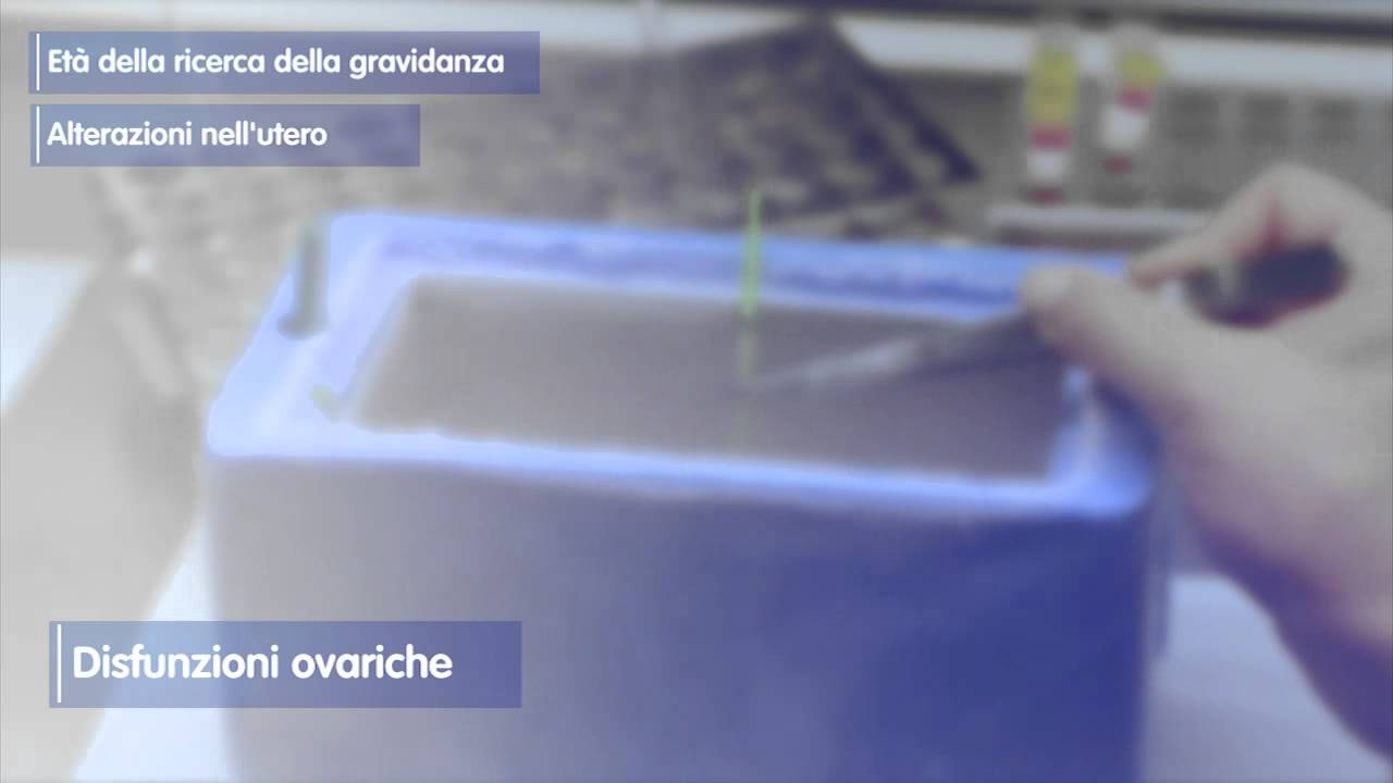 IVI - Cause della sterilit&agrave; UE-2015